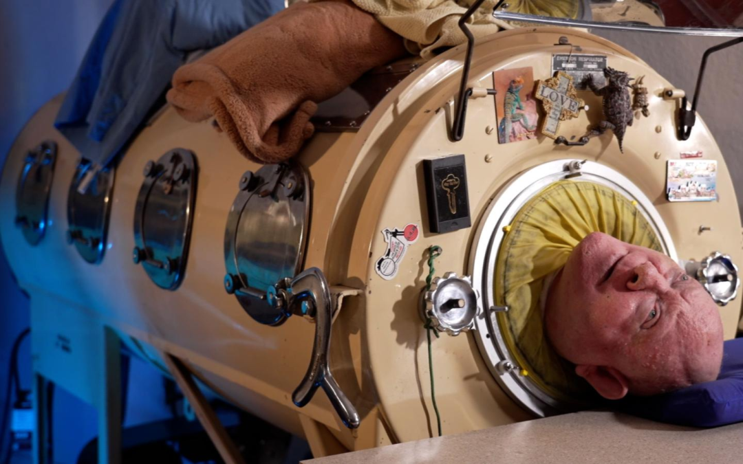 Murió el hombre que vivió 70 años en un pulmón de acero